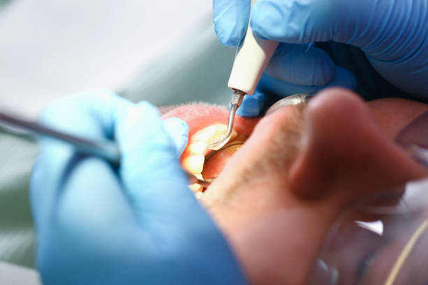 Best Root Canal Emergency Dentist  in Bull Valley, IL
