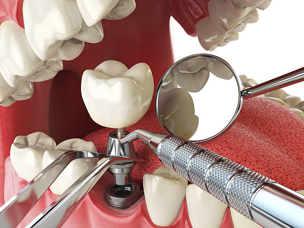 Best Tooth Infection Emergency Dentist  in Bull Valley, IL